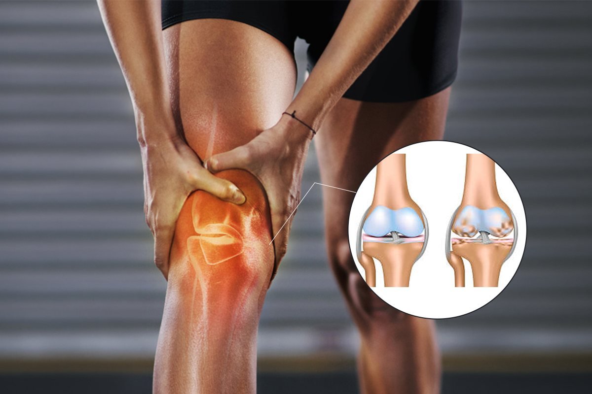 Degenerative Joint Disease, Osteoporosis