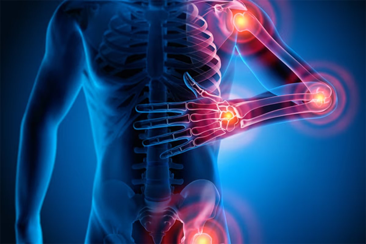 Soft Tissue Rheumatism